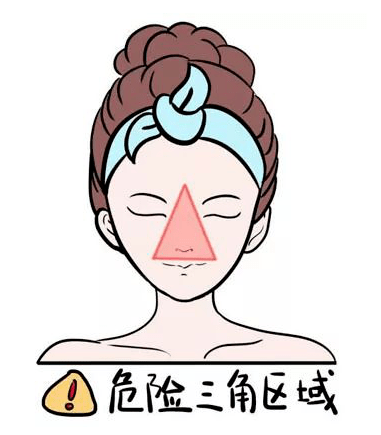 女孩擠痘痘引發(fā)顱內(nèi)感染!醫(yī)生說出真實發(fā)病原因