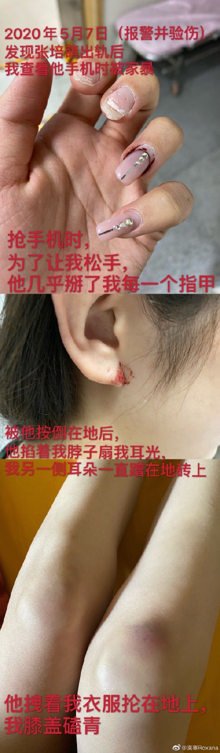 張培萌妻子稱(chēng)被家暴女兒被搶走 張培萌說(shuō)出真相