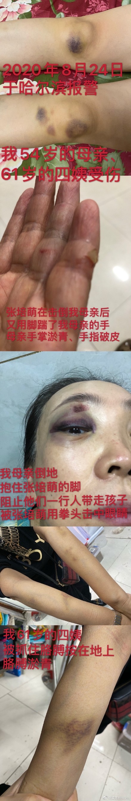 張培萌妻子稱(chēng)被家暴女兒被搶走 張培萌說(shuō)出真相