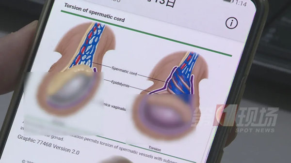 深圳一男孩摔跤致睪丸被切除